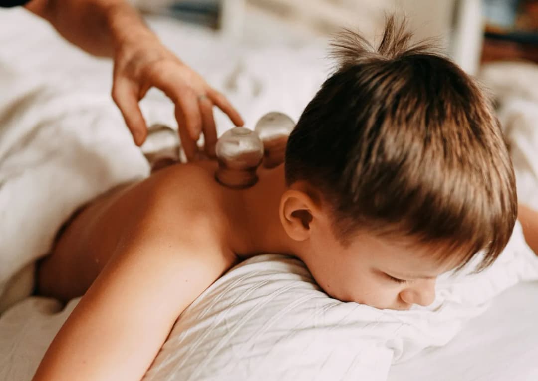 Stawianie baniek u dzieci - częstotliwość i bezpieczne odstępy